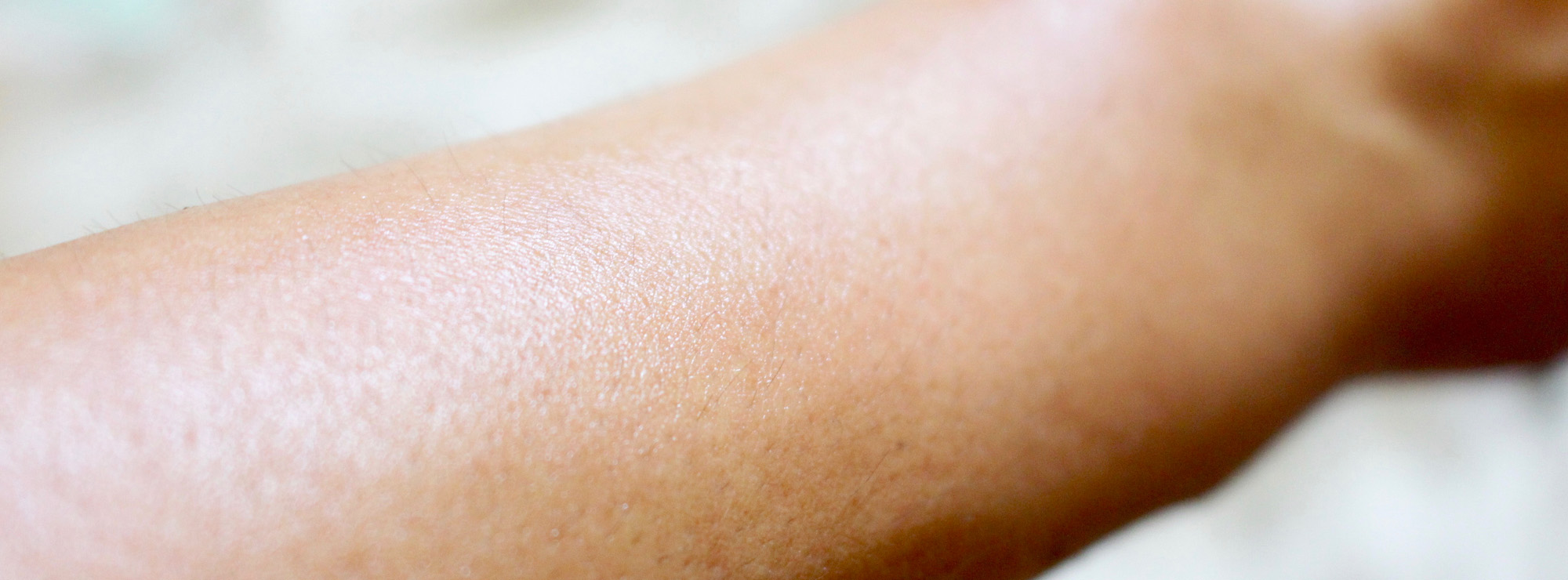 Scientists have 3D printed functioning artificial human skin 311