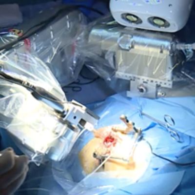 article_robot_surgeon