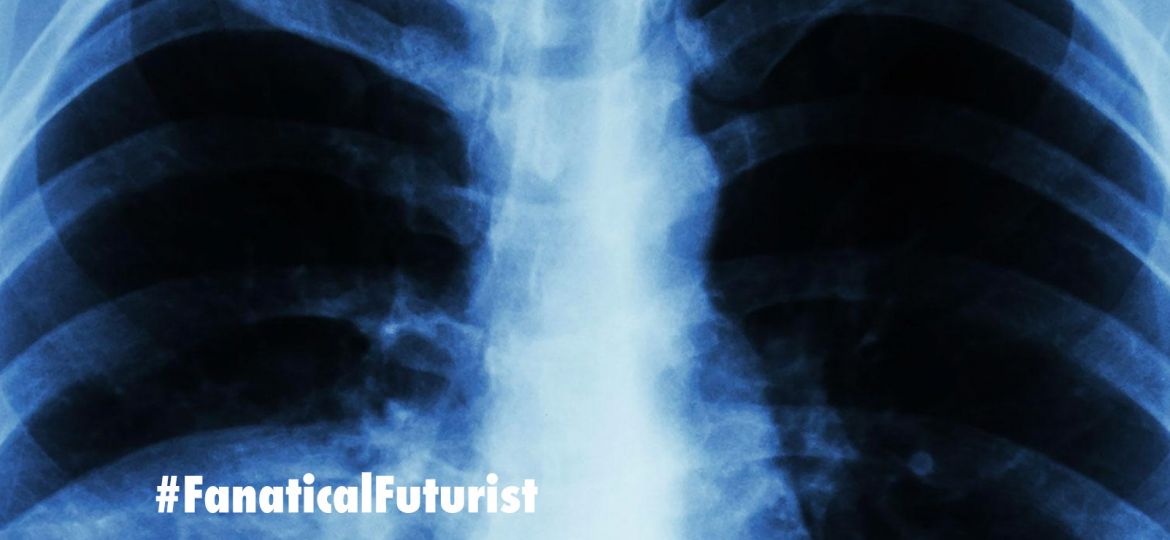 future_pneumonia_lungs