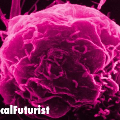 futurist_nanomachines_cancer